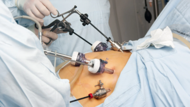 Role of Latest Technologies in Revolutionizing Bariatric Surgery for Safer, Faster Recovery