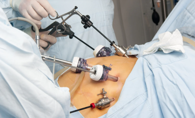 Role of Latest Technologies in Revolutionizing Bariatric Surgery for Safer, Faster Recovery